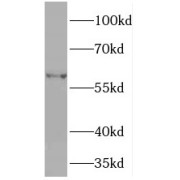WB analysis of mouse liver tissue, using PDIA5 antibody (1/1500 dilution).