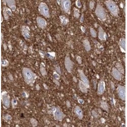 [Pyruvate Dehydrogenase (acetyl-Transferring)] Kinase Isozyme 2, Mitochondrial (PDK2) Antibody