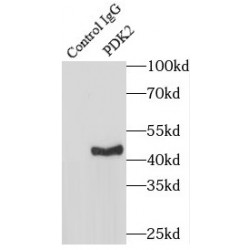 [Pyruvate Dehydrogenase (acetyl-Transferring)] Kinase Isozyme 2, Mitochondrial (PDK2) Antibody