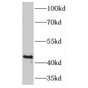 WB analysis of human heart tissue, using PDK2 antibody (1/500 dilution).