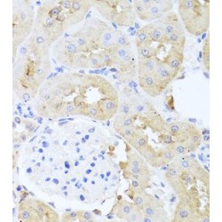 Pyruvate Dehydrogenase Kinase Isozyme 3 (PDK3) Antibody