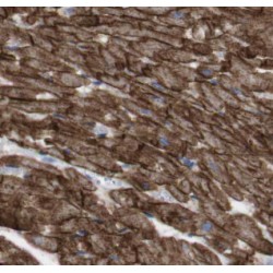 Programmed Cell Death 1 Ligand 1 (CD274) Antibody