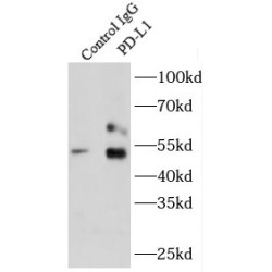 Programmed Cell Death 1 Ligand 1 (CD274) Antibody