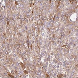PDZ And LIM Domain 7 (PDLIM7) Antibody