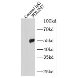 PDZ And LIM Domain 7 (PDLIM7) Antibody