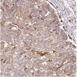 PDZ And LIM Domain 7 (PDLIM7) Antibody