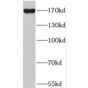 WB analysis of HT-1080 cells, using PDS5B antibody (1/400 dilution).