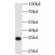 WB analysis of human kidney tissue, using PECR antibody (1/400 dilution).