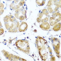 Period Circadian Protein Homolog 1 (PER1) Antibody
