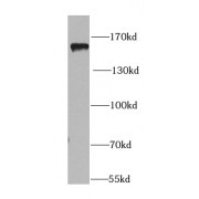 WB analysis of mouse brain tissue, using PER1 antibody (1/1000 dilution).