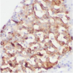Phospho Extracellular Signal Regulated Kinase (PERK) Antibody