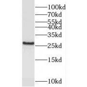 WB analysis of human testis tissue, using PEX11G antibody (1/500 dilution).