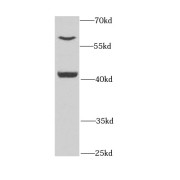 WB analysis of human liver tissue, using PEX14 antibody (1/1000 dilution).