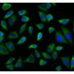 Peroxisomal Biogenesis Factor 5 (PEX5) Antibody