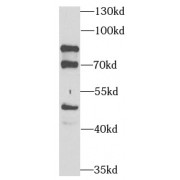 WB analysis of SW480 cells, using PEX5 antibody (1/1000 dilution).