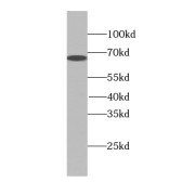 WB analysis of mouse brain tissue, using PEX5L antibody (1/600 dilution).