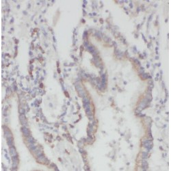 Prefoldin Subunit 2 (PFDN2) Antibody