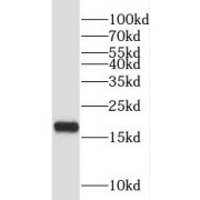 WB analysis of L02 cells, using PFDN2 antibody (1/300 dilution).