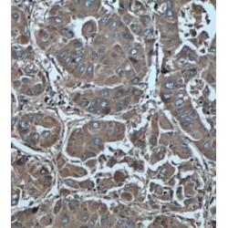 PFKFB3-Specific Antibody