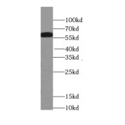 WB analysis of mouse thymus tissue, using PFKFB3-Specific antibody (1/600 dilution).