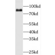 WB analysis of HeLa cells, using PFKL antibody (1/500 dilution).
