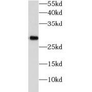 WB analysis of human brain tissue, using PGAM1 antibody (1/500 dilution).