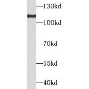 WB analysis of HeLa cells, using PGC1a antibody (1/1000 dilution).