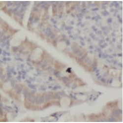 Phosphoglucomutase-1 (PGM1) Antibody