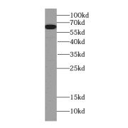 WB analysis of HepG2 cells, using PGM1 antibody (1/1000 dilution).