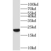 WB analysis of Human brain tissue, using PGPEP1 antibody (1/600 dilution).