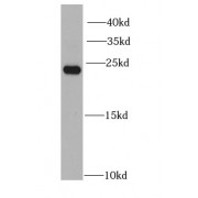 WB analysis of HEK-293 cells, using PGRMC1 antibody (1/1000 dilution).