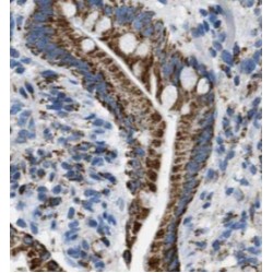 ACC Synthase Like Protein 1 (PHACS) Antibody
