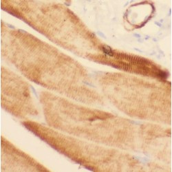 Phosphorylase Kinase Regulatory Subunit Beta (PHKB) Antibody