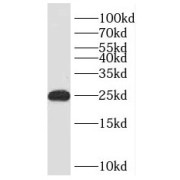 WB analysis of human placenta tissue, using PHLDA2 antibody (1/800 dilution).