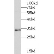 WB analysis of HeLa cells, using Marcks antibody (1/500 dilution).