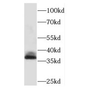 WB analysis of SH-SY5Y cells, using PHOX2A antibody (1/600 dilution).