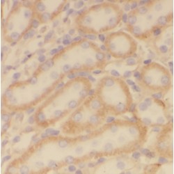 Phytanoyl-CoA 2-Hydroxylase (PHYH) Antibody