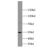 WB analysis of rat lymph tissue, using PIK3R5 antibody (1/300 dilution).