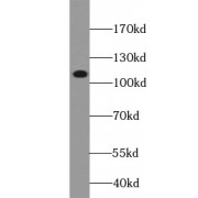 WB analysis of K562 cells, using PIK3CA antibody (1/1000 dilution).
