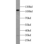 WB analysis of human brain tissue, using PIK3CA antibody (1/1000 dilution).