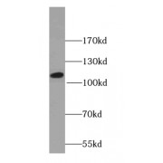 WB analysis of HepG2 cells, using PIK3CB antibody (1/500 dilution).