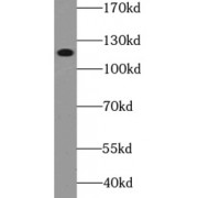 WB analysis of HepG2 cells, using PIK3CB antibody (1/500 dilution).