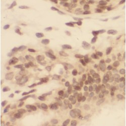 Phosphatidylinositol 4-Kinase Alpha (PI4KA) Antibody