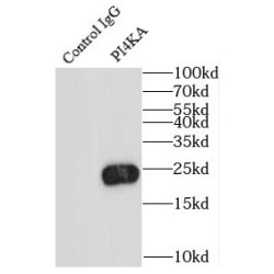 Phosphatidylinositol 4-Kinase Alpha (PI4KA) Antibody