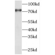 WB analysis of HepG2 cells, using PIAS1 antibody (1/2000 dilution).