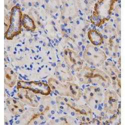Progesterone-Induced-Blocking Factor 1 (PIBF1) Antibody