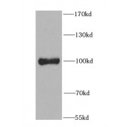 WB analysis of mouse heart tissue, using PIBF1 antibody (1/1000 dilution).