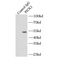 Protein Interacting With Protein Kinase C Alpha 1 (PICK1) Antibody