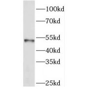 WB analysis of mouse brain tissue, using PICK1 antibody (1/500 dilution).