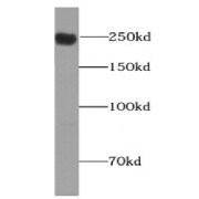 WB analysis of HepG2 cells, using Piezo1 antibody (1/500 dilution).